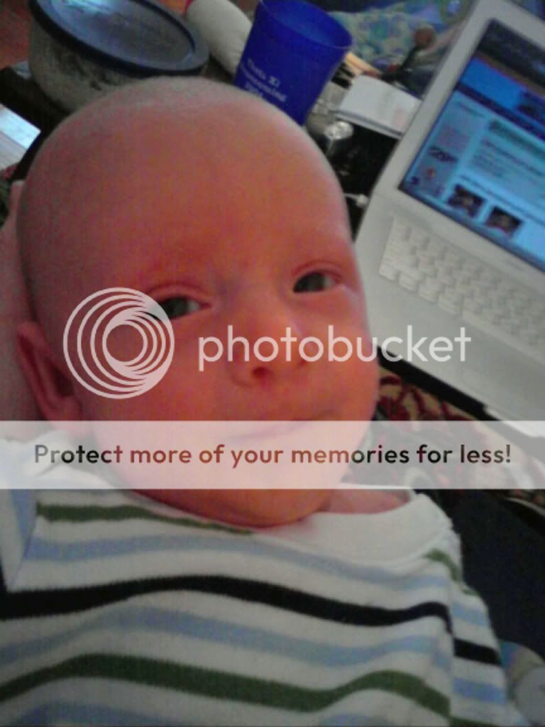 recessed chin babies? BabyCenter